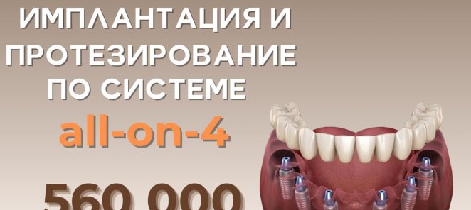 Имплантация и протезирование 