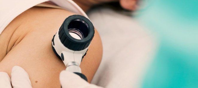 Лазерное и фотодинамическое удаление новообразований