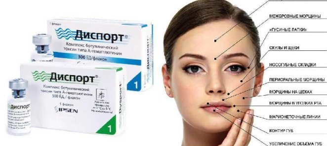 Избавление от морщин препаратом Диспорт