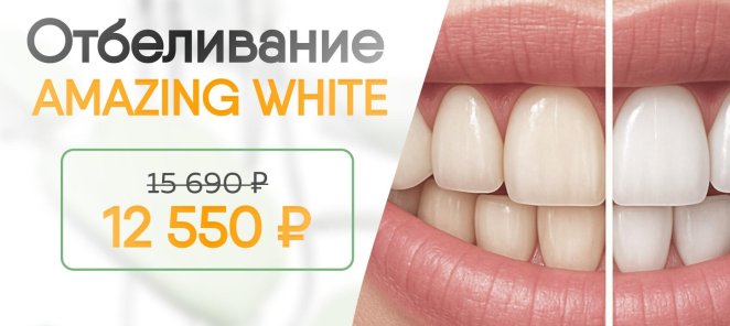 Отбеливание зубов Amazing White