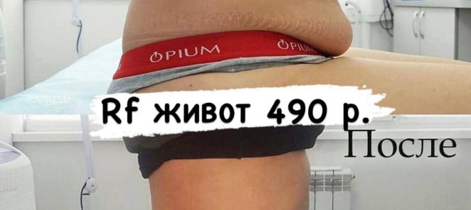 Рф лифтинг тело 490 р.