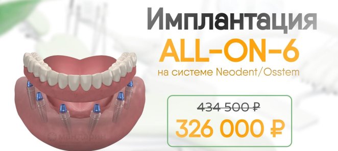 -108 тыс. на имплантацию ₽