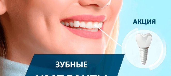 Установка зубных имплантов Osstem и Dentium
