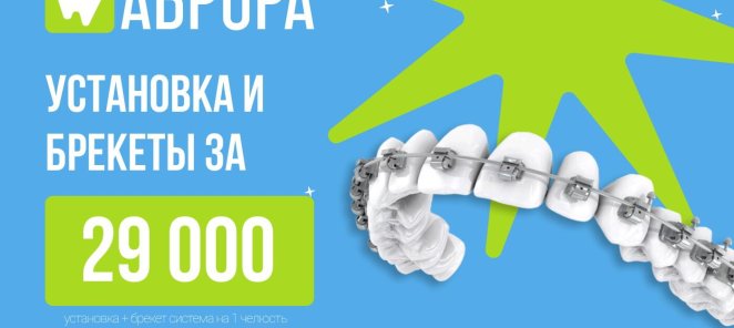 Брекеты по акции 29.000 руб. вместо 44.000 руб.