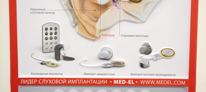Пробное ношение слухового аппарата