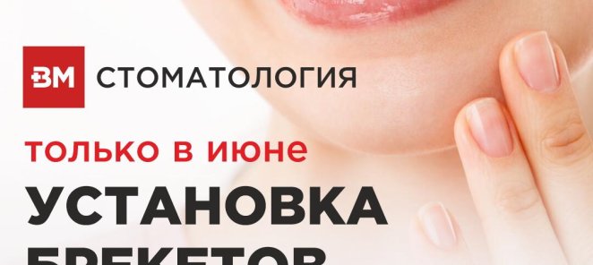 БРЕКЕТЫ