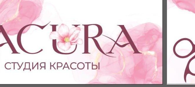 Праздники закончились, а отёки остались?