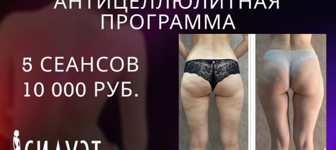 Абонемент: антицеллюлитная программа всего 10 000 рублей