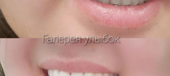 Скидка от 15 до 50% на первое посещение