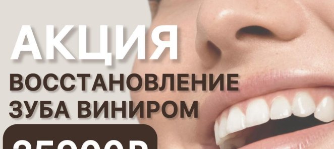 Восстановление зуба виниром 25900 руб