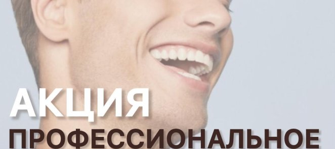 Профессиональное отбеливание зубов -20% Zoom4