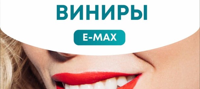Керамические виниры E-MAX