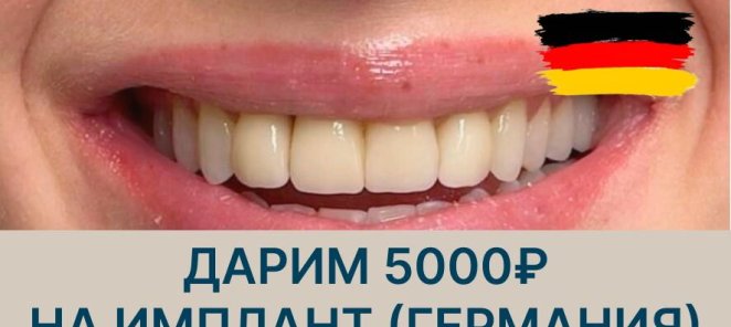 Дарим 5000₽ на имлант из Германии