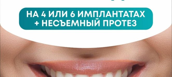 Зубы за 1 день