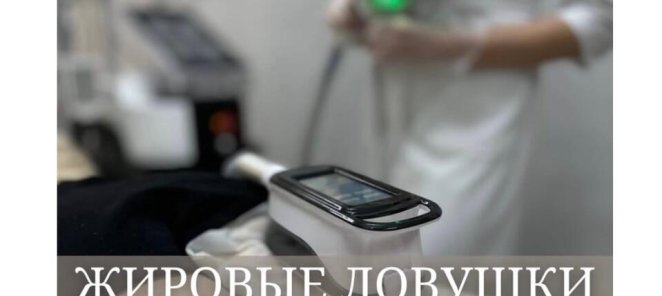 Криолиполиз