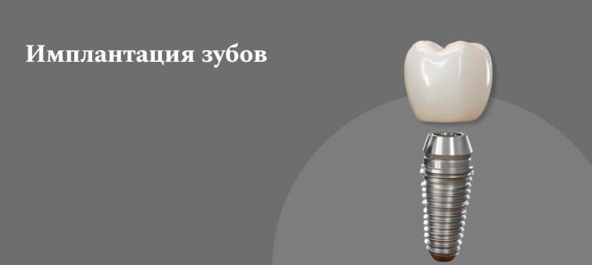 Имплантация зубов от 25000 руб