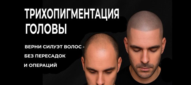 Трихопигментация SMP всего за 7000р!