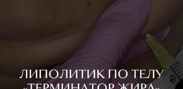 Липолитики