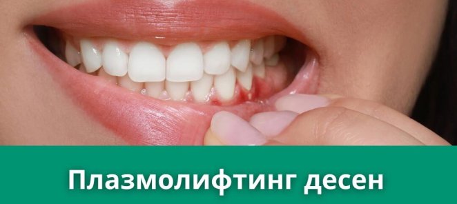 Плазмолифтинг десен