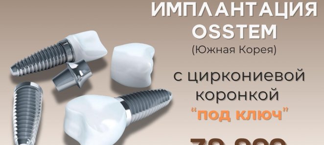 Имплантация Osstem (Южная Корея) 