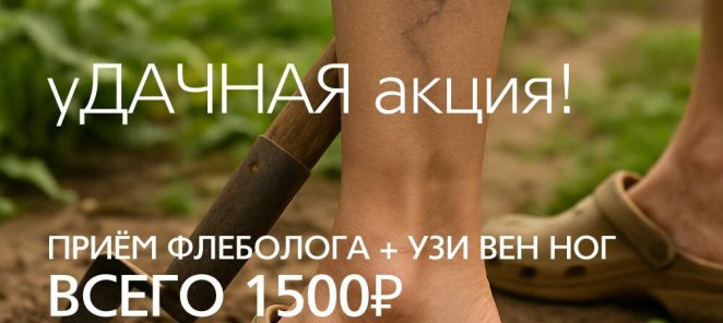 уДачная акция: приём флеболога + УЗИ вен ног за 1500 рублей
