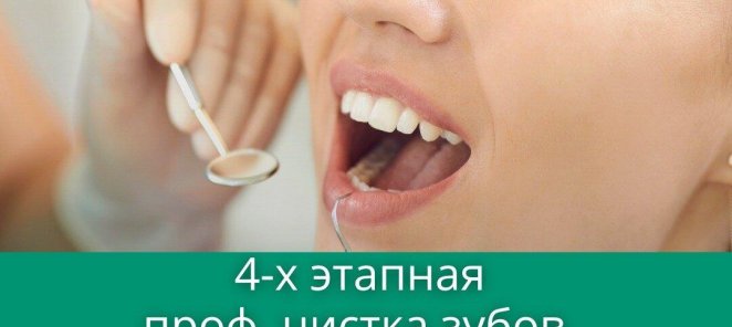 4-х этапная профессиональная гигиена рта и зубов