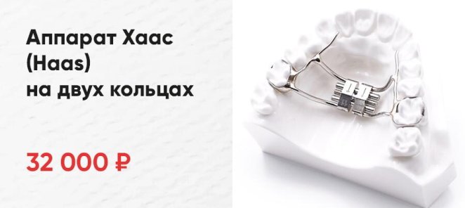 Аппарат Хаас (Haas) на двух кольцах