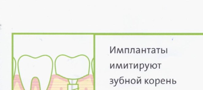 Имплантат STRAUMANN от 63 000 руб.
