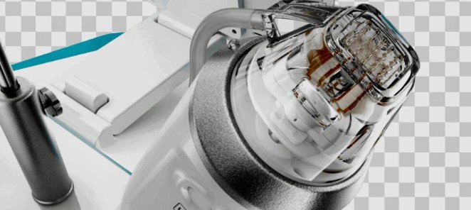Двойная выгода с ELLISYS SENSE: RF-лифтинг для сияющей кожи