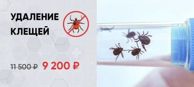Удаление клещей 9200 рублей