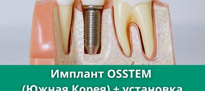OSSTEM IMPLANT (Южная Корея) + установка