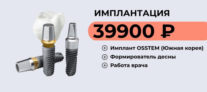 Имплантация Osstem - 39900 ₽