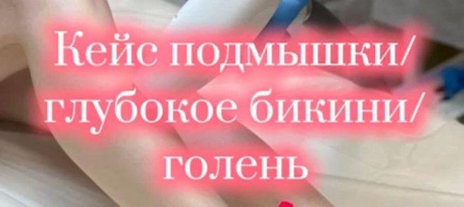 Лазерная эпиляция