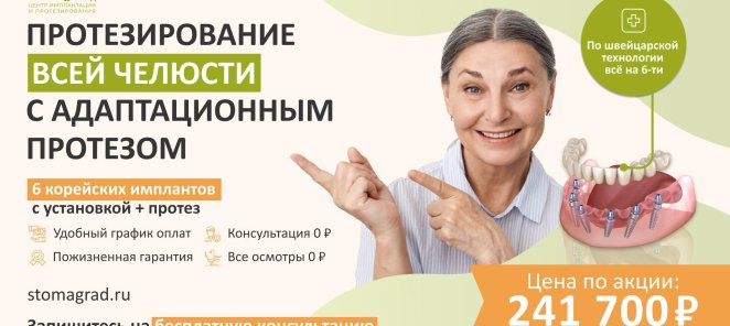 Протезирование всей челюсти на 6 имплантах