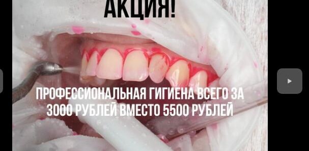 Профессиональная гигиена всего за 3000р