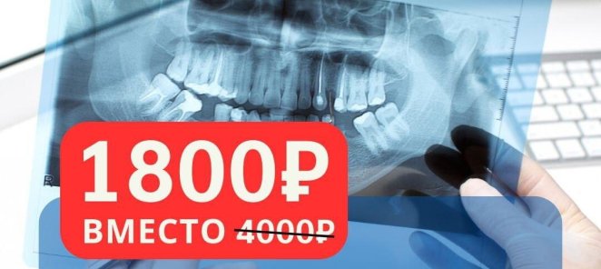 Консультация любого стоматолога с 3D-снимком