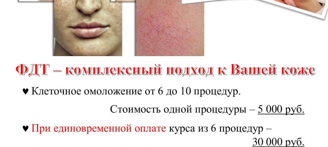 Акция на ФДТ!