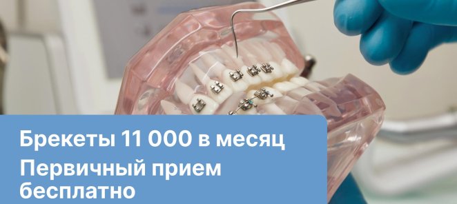 Улыбка мечты с брекетами всего за 11 000 ₽ в месяц!