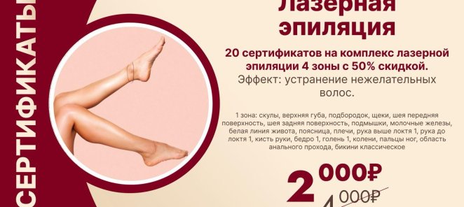 Лазерная эпиляция