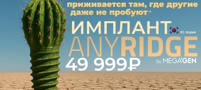 Имплант AnyRidge 49999 руб.