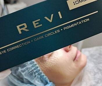 Биоревитализация REVI Silk