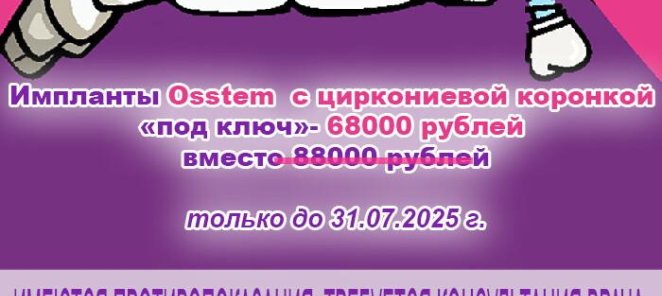 Акция на имплантацию