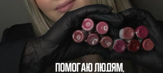 Помощь людям с алопецией
