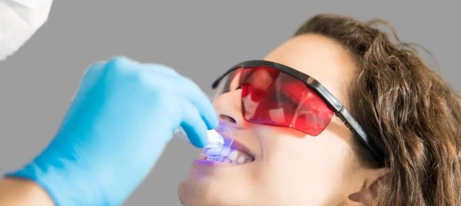 Самый безопасный комплекс отбеливания Biolase