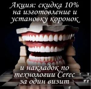 – 10% на изготовление и установку коронок по CEREC!