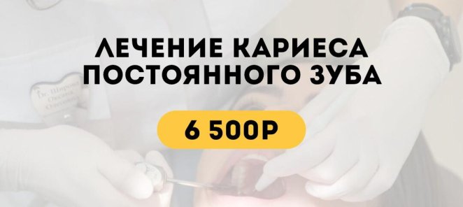 Лечение кариеса постоянного зуба за 6500