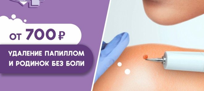 УДАЛЕНИЕ ПАПИЛЛОМ И РОДИНОК БЕЗ БОЛИ от 700₽