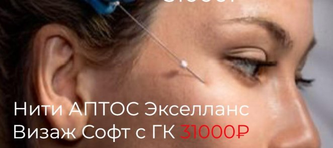 1️⃣ Нитевая подтяжка лица