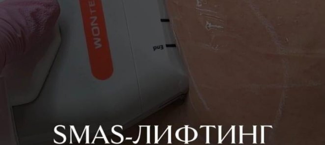 SMAS-лифтинг