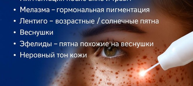 Пигментные пятна - удаление с лица. Акция 11200 р!